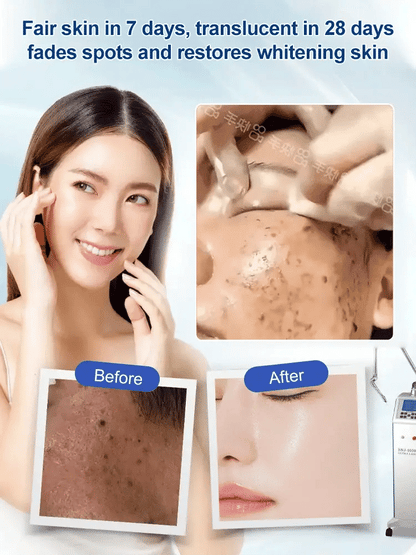 🎁LAST DAY 50% OFF🎁Spot Fading Urea Cream